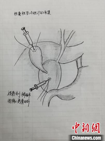 西安护士变身“灵魂画手”手绘上百张手术图为患儿家属解忧